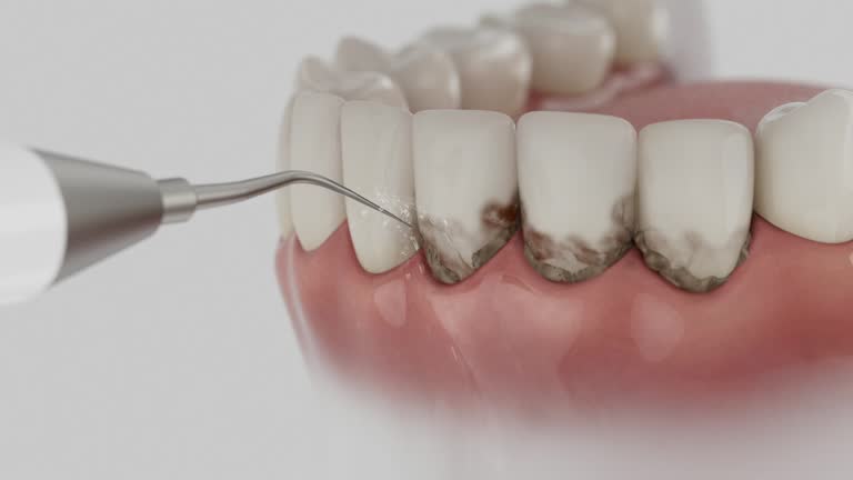 Trusted Wisdom Tooth Removal service in Upland, PA - Dentist Open Now